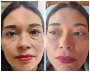 Péptidos y Polinucleótidos