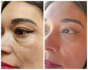 Péptidos y Polinucleótidos