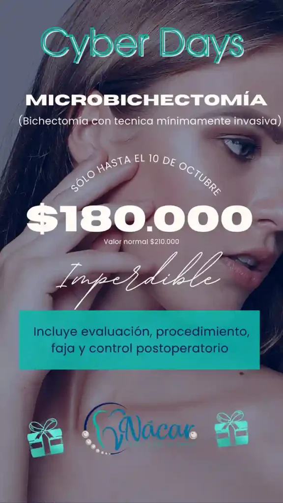 Micro Bichectomía de Última Generación