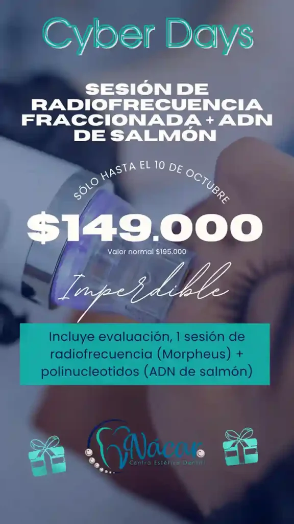 Radiofrecuencia Fraccionada + Polinucleótidos ADN de Slamón