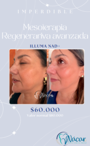 Promo iLluma NAd+ Mes de las Madres