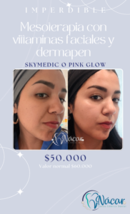 Promo Vitaminas Faciales Mes de las Madres