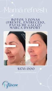 Promo Dysport 3 Zonas Mes de las Madres