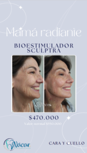 Promo Sculptra Mes de las Madres