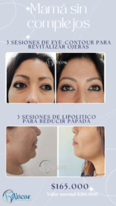 Promo Revitalización de Ojeras Mes de las Madres