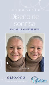 Promo Diseño de Sonrisa Mes de las Madres