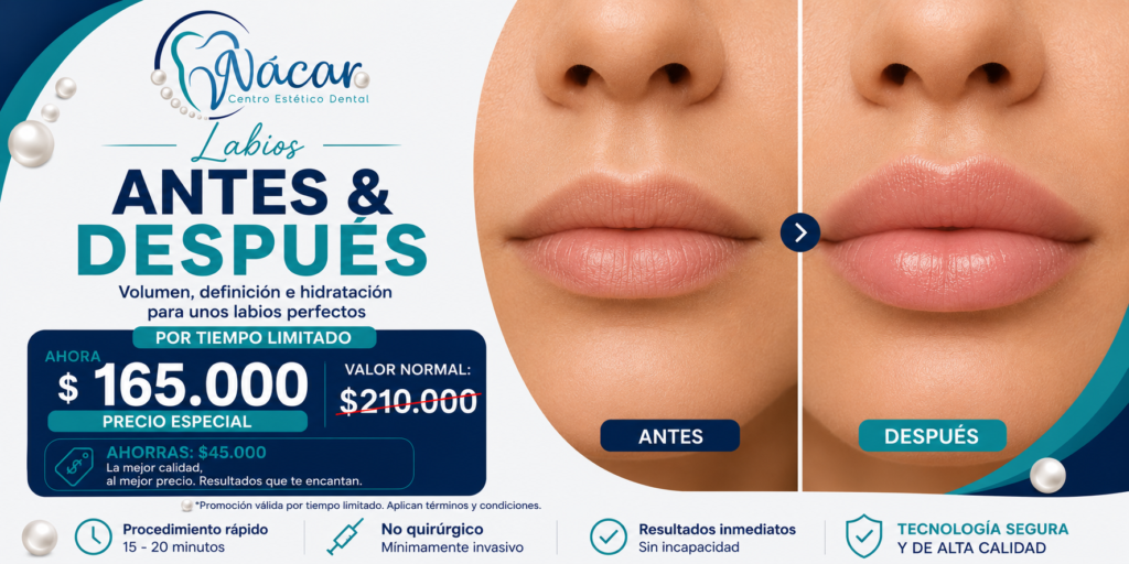 Promo labios