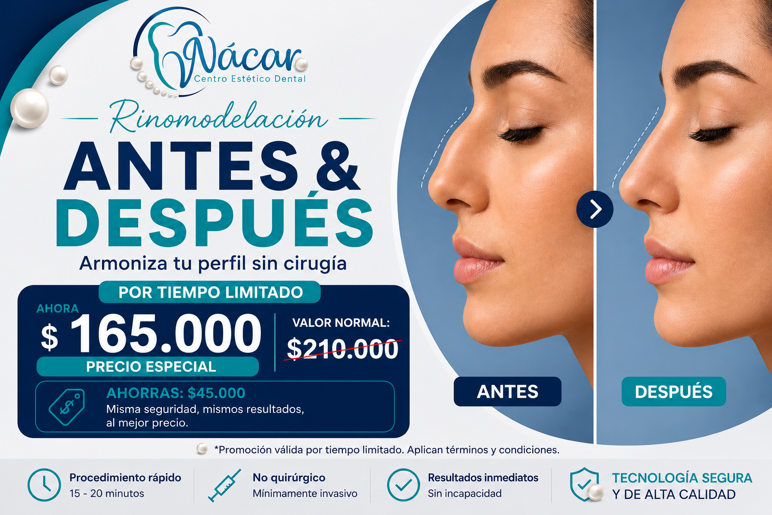 Promo Rinomodelación